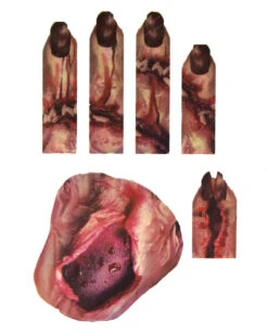 3D Zombie Handtattoo Mit Wunden & Maden