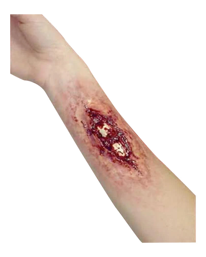 Knochenbruch / Broken Bone Wunde 2 Knochenbruch / Broken Bone Wunde – Bild 2