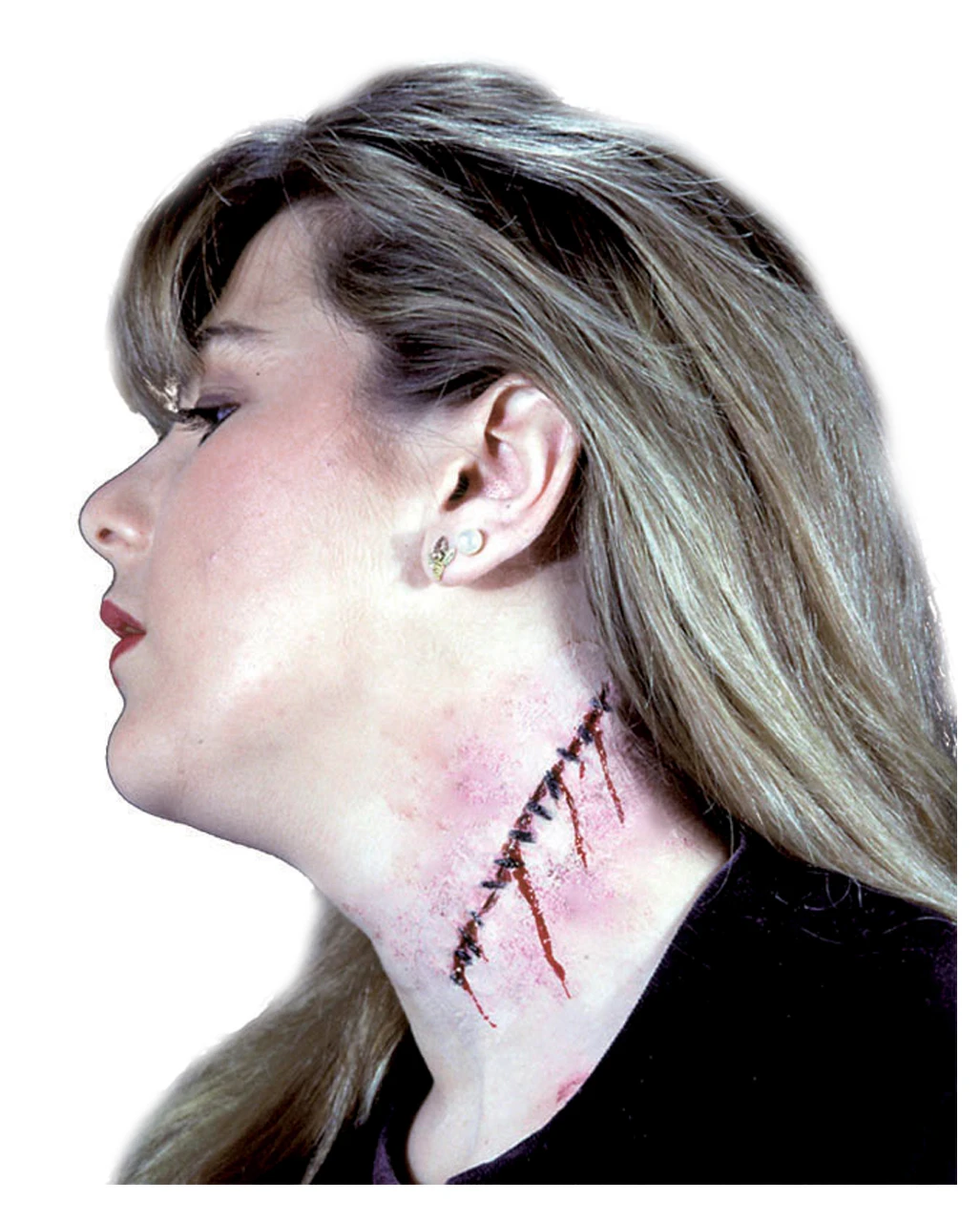 Genähte Latexwunde 1 Genähte Latexwunde